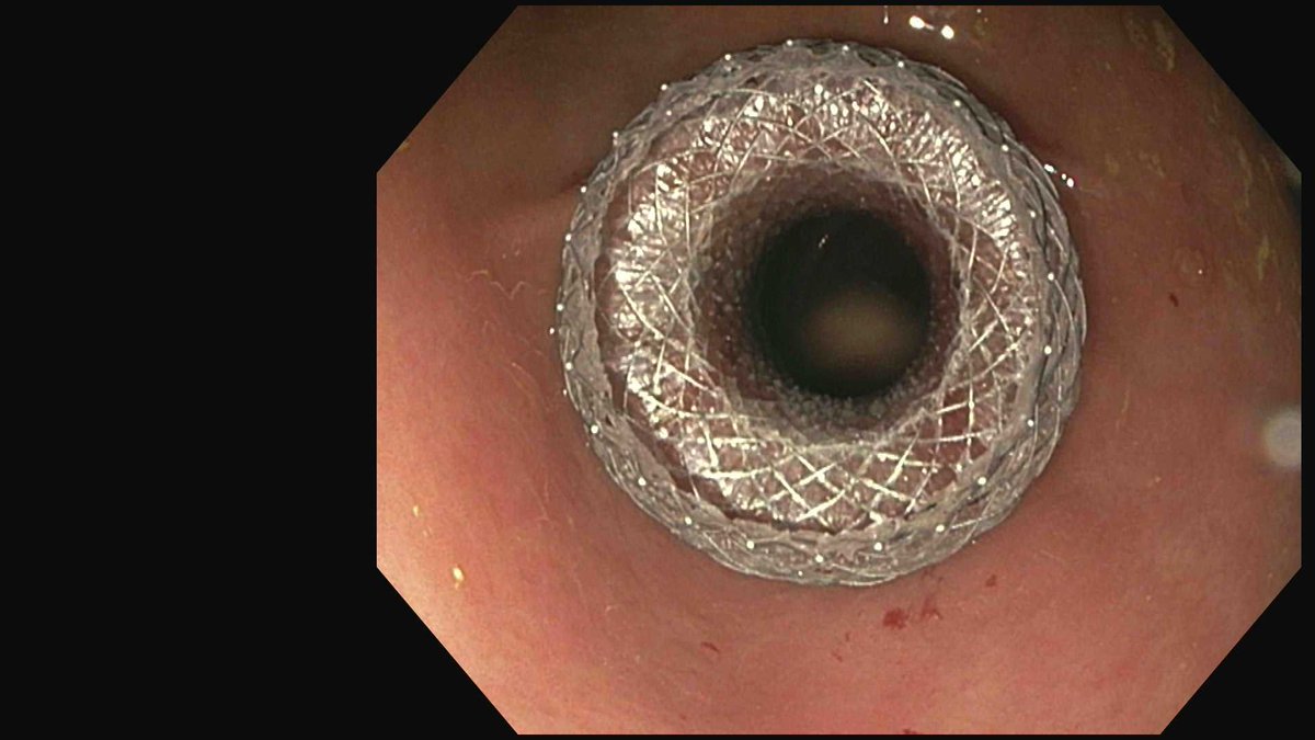 Douglas G. Adler MD, FASGE, FACG, AGAF tweet media