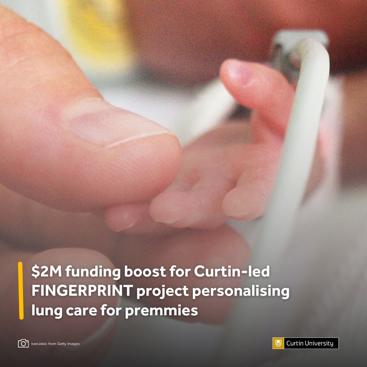 Curtin Media (@curtinmedia) on Twitter photo Crafting custom solutions to combat chronic lung disease in people born #preterm! 🌟 Thanks to a $2M Medical Research Future Fund grant, <a href="/CurtinUni/">Curtin University</a>’s FINGERPRINT aims to develop personalised treatments for patients. Learn more. 👉 tinyurl.com/584njr8k Crafting custom solutions to combat chronic lung disease in people born #preterm! 🌟 Thanks to a $2M Medical Research Future Fund grant, <a href="/CurtinUni/">Curtin University</a>’s FINGERPRINT aims to develop personalised treatments for patients. Learn more. 👉 tinyurl.com/584njr8k