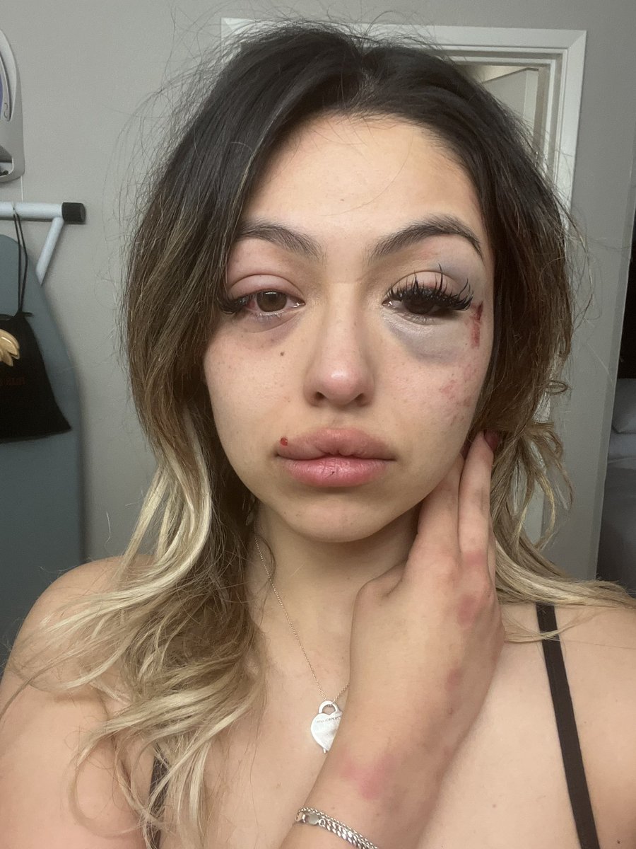 xoacvxo's tweet photo. tw: dv

To everyone in Las Vegas please be aware of who Franchesco Fuentes really is! This "man" is an abusive manipulator and needs to be held accountable! He lives on the East side &amp; drives a white GMC truck.
!!!! Please share/rt!!!! https://t.co/AMmH72X3fA