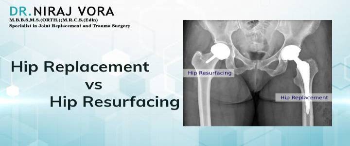 #TotalHipReplacement vs #HipResurfacing | Dr Niraj Vora

With a wide range of motion and resilience to absorb extraordinary amount of forces while bearing the weight we walk, run, jump and leap..
Know more at: drnirajvora.com/blog/total-hip…