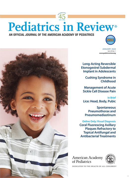 drmimikim's tweet photo. Cushing Syndrome in Childhood - read about a great teaching case and review the topic in #PediatricsInReview #CushingSyndrome (in kids) @AAPJournals @AAPCA2 https://t.co/nqZeiICBay