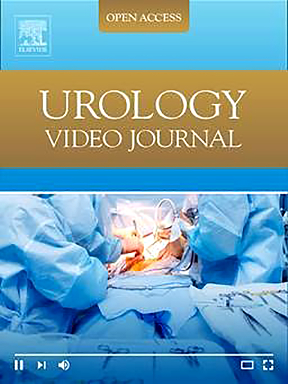 Dive into cutting-edge urological procedures with the Urology Video Journal's special issue! Techniques during robotic partial nephrectomy View articles: spkl.io/60154agBB #Urology #MedicalResearch #SurgeryVideos