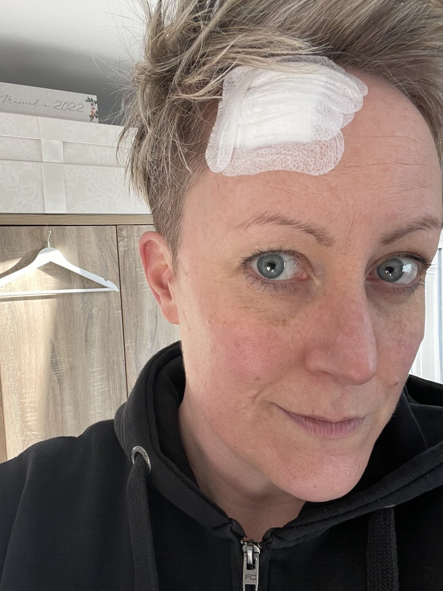 becks_bryant's tweet image. Long Day in Hospital Yesterday for #MohsSurgery on my face. 3 times under the knife and an hour of a fantastic team battling to get the 16 stitches to sit nice! Ridiculously sore today. The worst bit is no exercise for 2 weeks 🫣 , #FirefighterLife #decon #Contaminants  7th BCC!