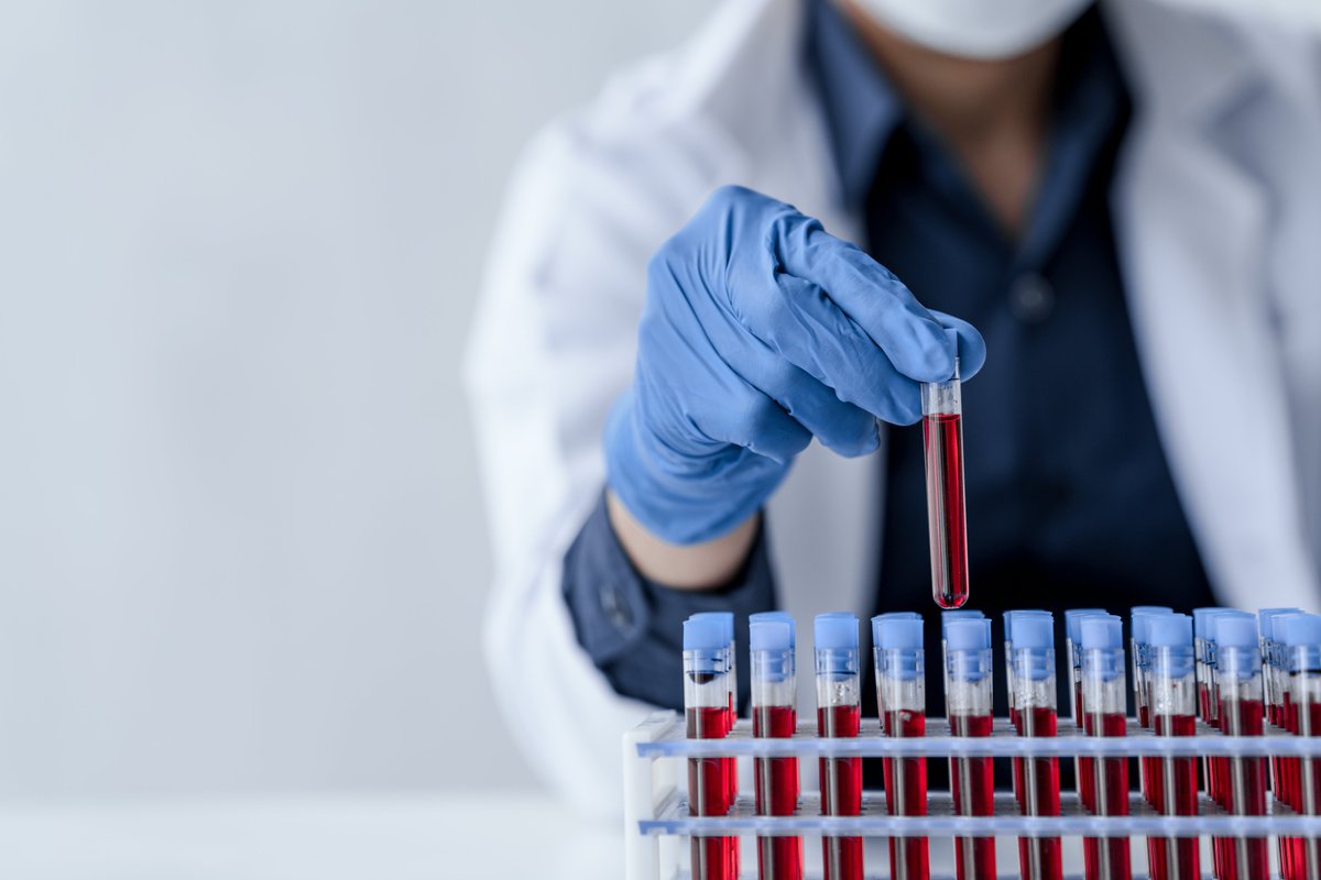 Groundbreaking research has identified four proteins, GFAP, NEFL, GDF15, and LTBP2, that can predict the onset of dementia more than a decade before diagnosis. You can find the research on Nature Aging via the following link: nature.com/articles/s4358…