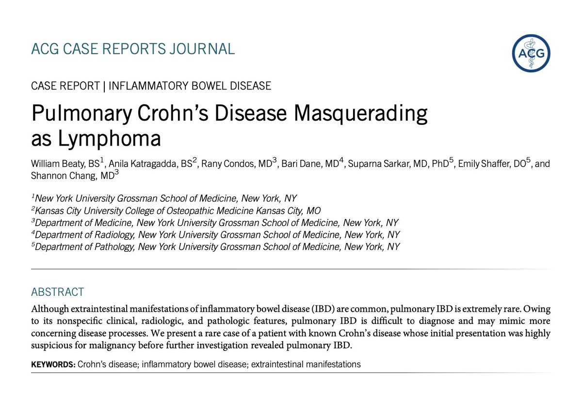 NYULangonePCCSM's tweet photo. A multidisciplinary team including our own @rany_condos Describe Pulmonary Crohn's Disease Masquerading as Lymphoma in @ACGCRJ 

🔓  https://t.co/RwnsyONOty
#gastroenterology #ILD #Pulmonary #PCCM #Lung #Lungdisease https://t.co/c60lcP2u0W