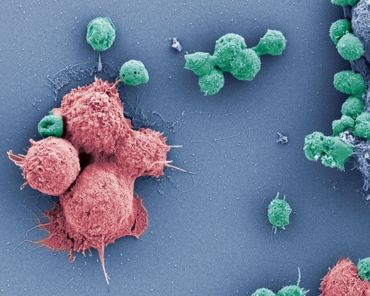 Join us for a conference on #cancer #Immunotherapy , co-organised by <a href="/DanaFarber/">Dana-Farber</a>, @NatRevImmuno, <a href="/NatImmunol/">Nature Immunology</a>, <a href="/NatureMedicine/">Nature Medicine</a>, <a href="/NatureCancer/">Nature Cancer</a> on June 10-12th in Boston. Please submit your abstract by April 12. conferences.nature.com/CancerImmunoth…