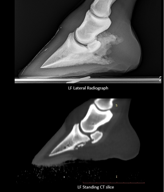 Equina_AstoCT's tweet photo. 🐴 24-year-old gelding with P3 Sequestrum & a stubborn wound. With Dr. Joanne Kramer DVM MS DACVS & University of Missouri team, standing CT revealed hidden fragments, leading to successful surgery & aftercare. 🙌 #EquineHealth #VeterinarySuccess #AstoCT 🐎✨ https://t.co/8YsANEFCDz