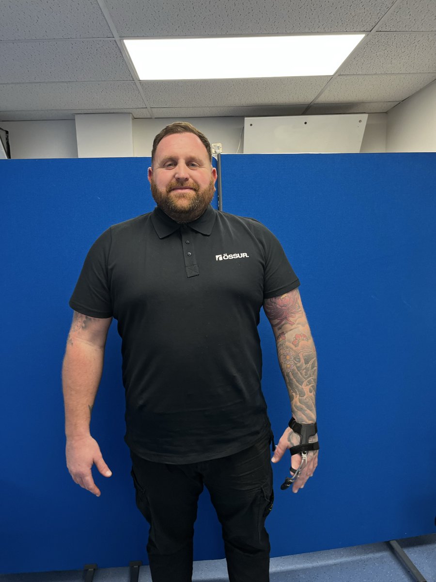 ossur_uk's tweet image. Introducing our newest @NPDevices ambassador, James Cathcart! Landscape gardener James lost his index finger 23 years ago in a work accident. Now he can use his phone without dropping it and use all his work tools with confidence
#ItsAllAboutFunction #LifeWithoutLimitations