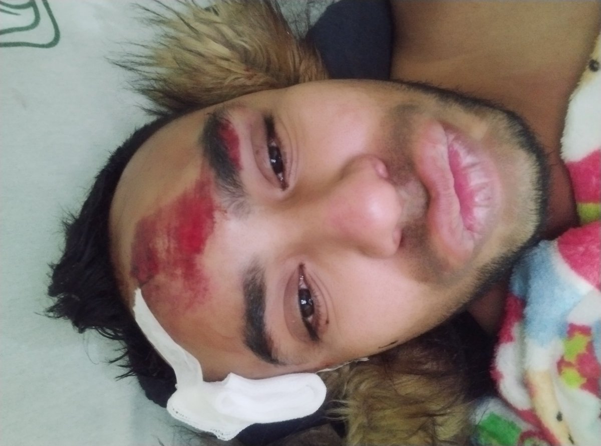 marginadoone's tweet image. Upss