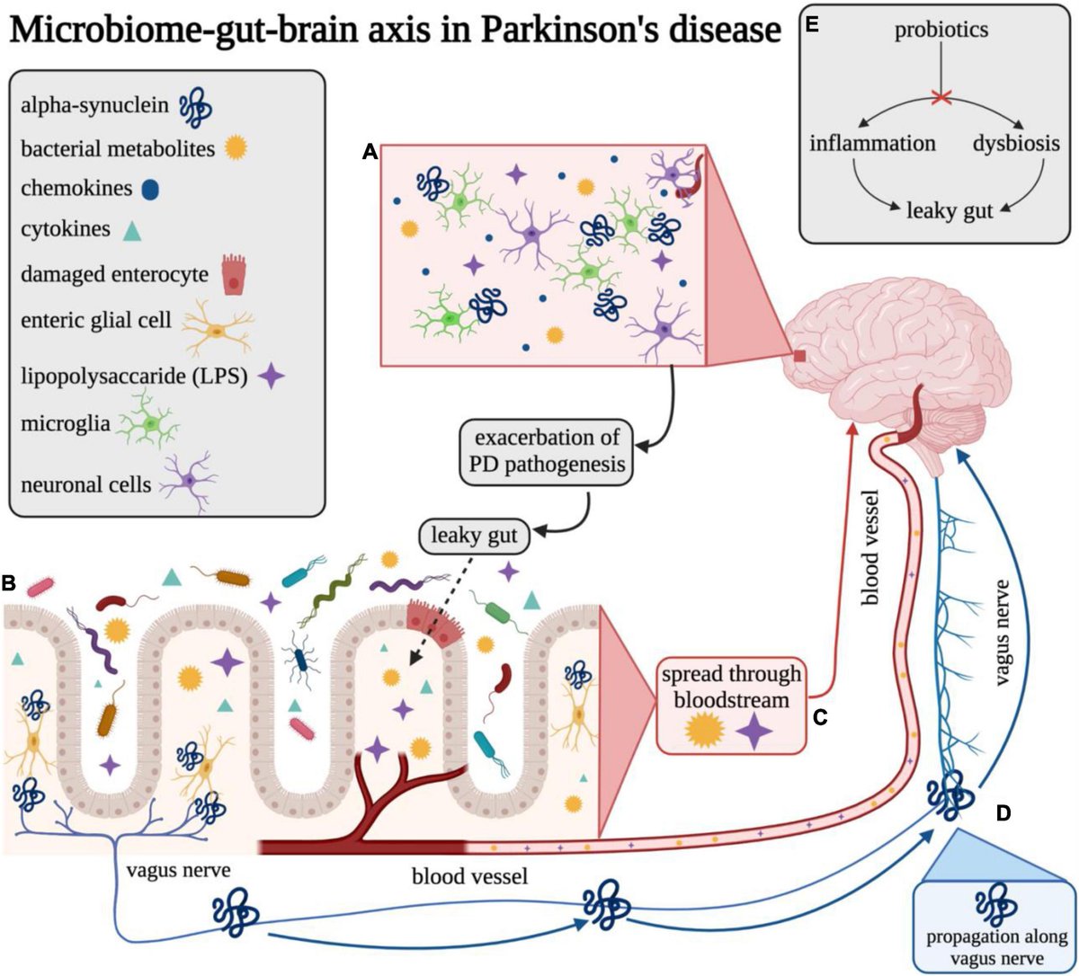 Overview of the gut–brain axis in Parkinson’s disease. What is your opinion? Credits: Klann et al. #MedTwitter