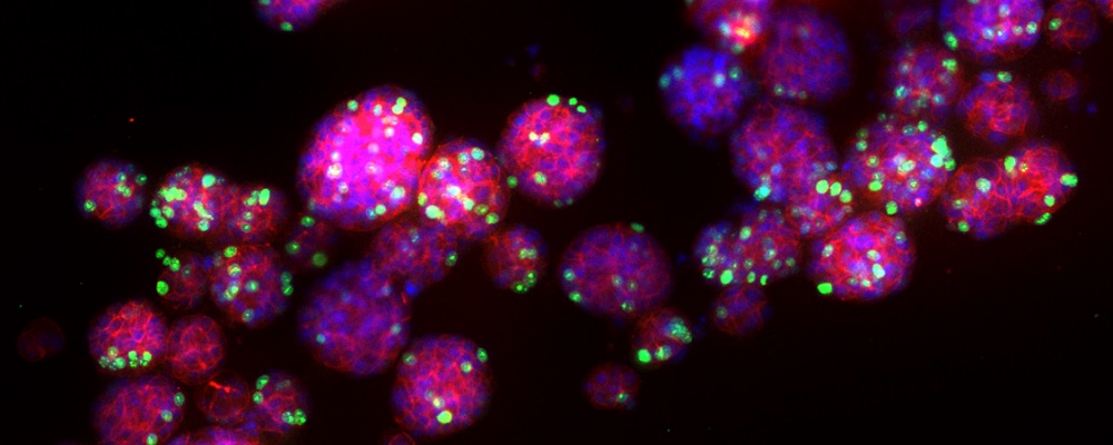 University of Waterloo Chemical Engineering tweet media