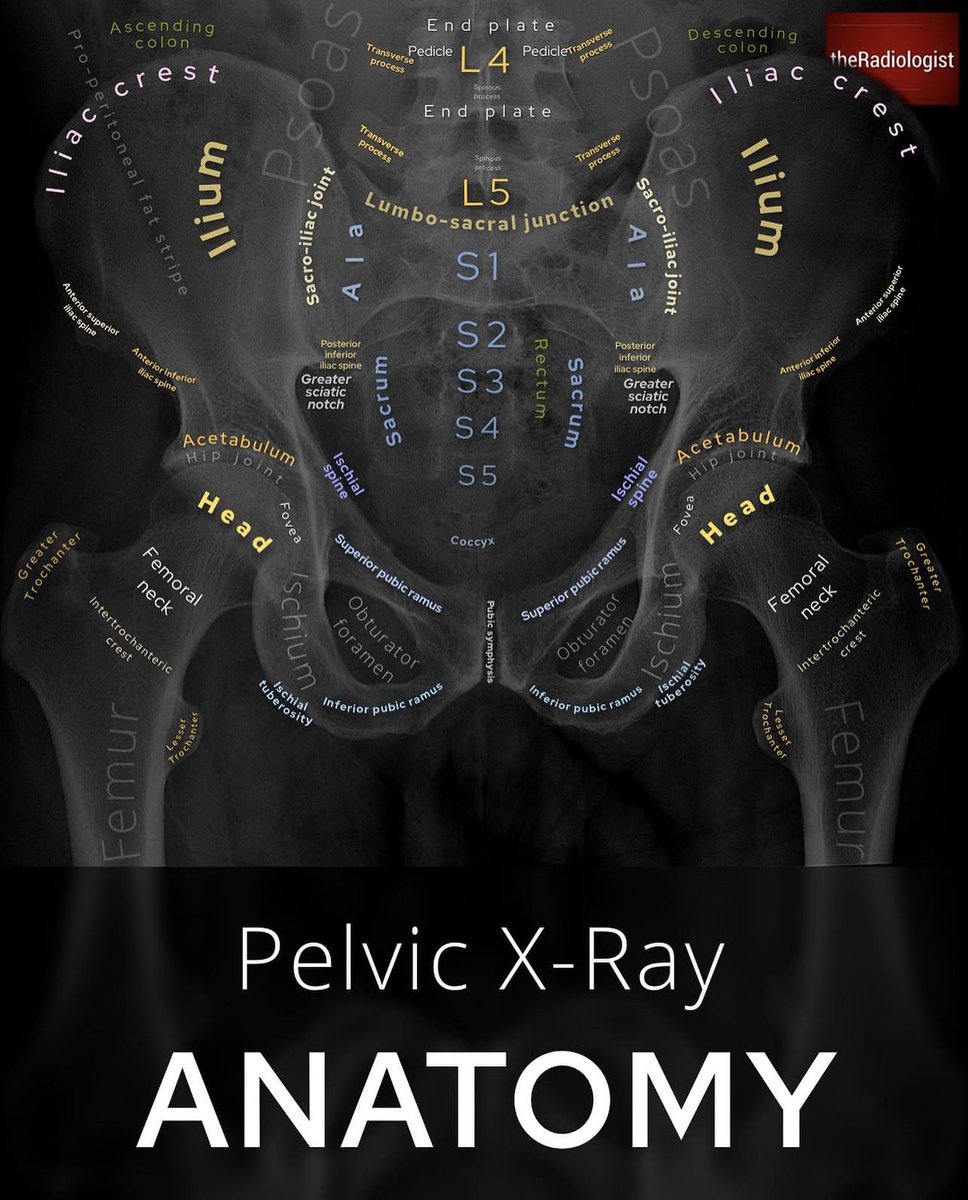 AbdullahNMT's tweet image. اناتومي الحوض في #الاشعة_السينية☢️🩻
Pelvic #X_ray anatomy