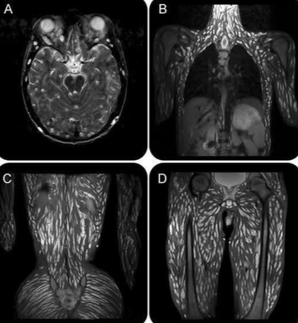 MorbidKnowledge's tweet image. Harrowing images show an 18-year-old boy infected with worm parasites.