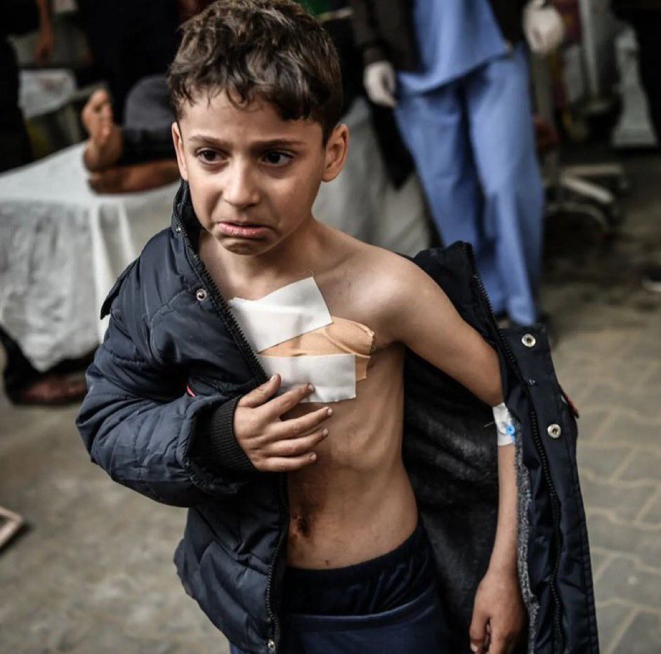 Susma_maa's tweet photo. Kalbi ağrıyor ! 

Niye mi ? 

Sağır ve k’ör olan islam alemi yüzünden …

CEASFİRE FOR GAZA
Boykotla Kurtar https://t.co/fb9EWykEPn