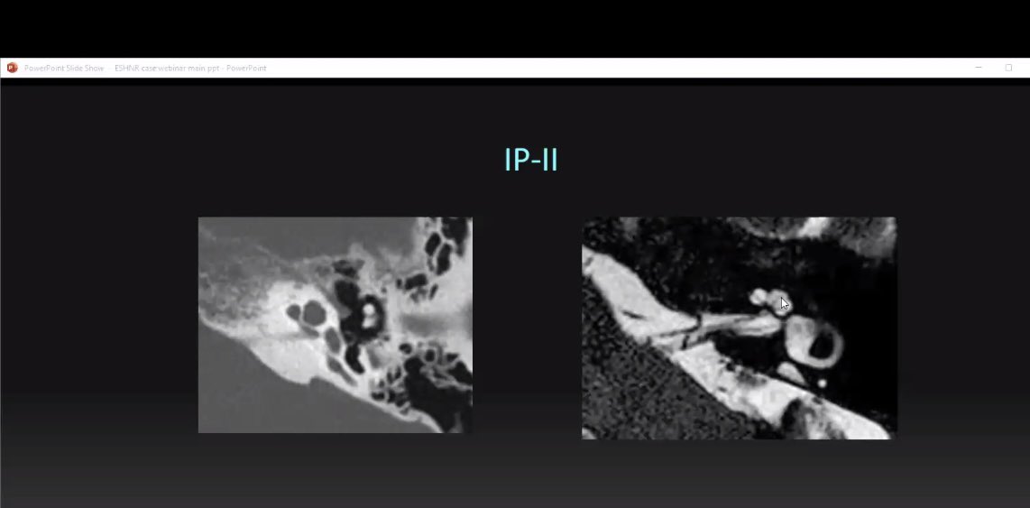 😉don‘t worry too much about embryology ☝️describe the anatomy, this is the most important @amyfjuliano @ASHNRSociety @YPekcevik @jussihirvonen @darkahadnadjevs @Bert_DeFoer @vassallo_edith