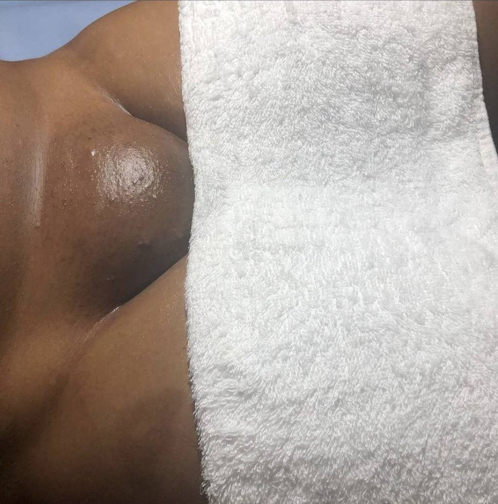 omodingjoel4's tweet image. The Doctors' advise went wrong
This is not healthy at all…don’t wax to this extent