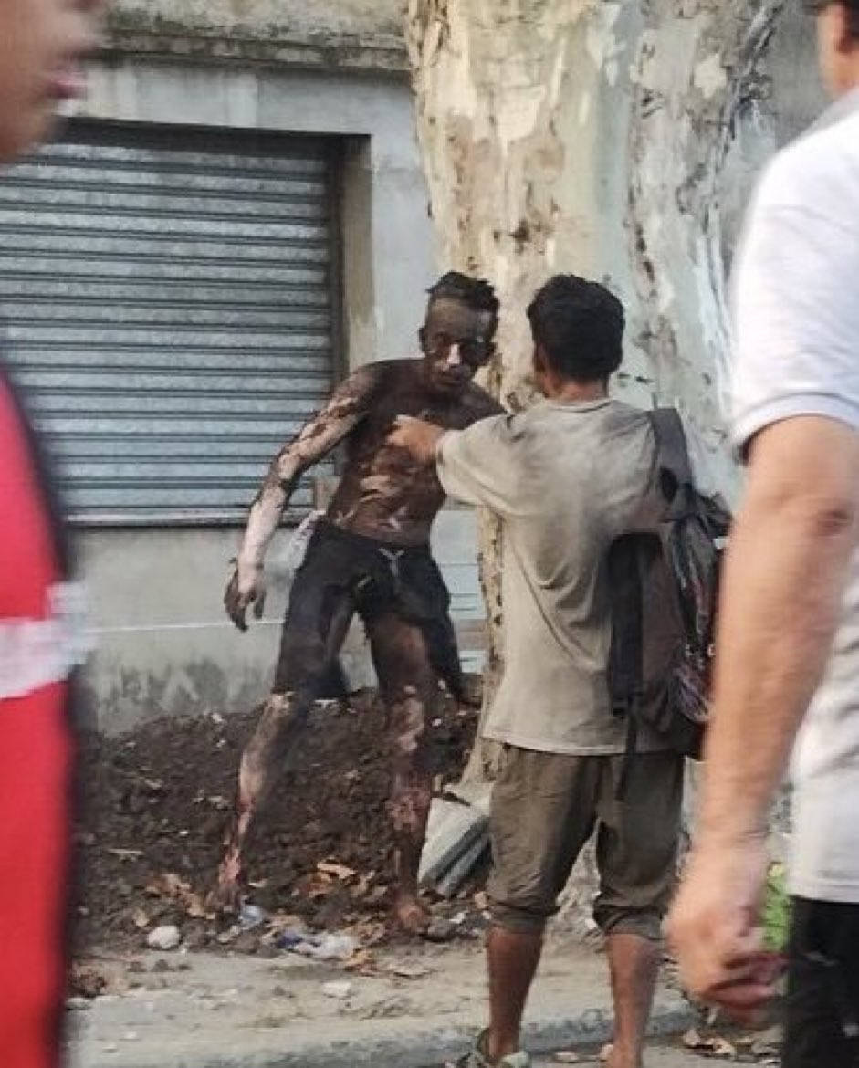 emalaponte's tweet photo. Decir que éste chico de 20 años murió electrocutado por robar cables es ver la foto y no la película.

Murió por la pobreza. 

Murió por la corrupción, la impericia y el despilfarro de gente patética que gasta la que no tenemos.

Que esta imagen los haga recapacitar. https://t.co/8L1RI38cc1