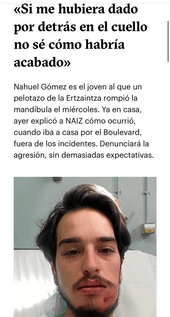 JonInarritu's tweet photo. Agerian geratu da beste behin Foam pilotak gomazko pilotak bezain arriskutsuak izan daitezkeela. 

Azken urteetan behintzat hiru kasu ezagutu ditugu Euskal Herrian. 

Beste Cabacas kasu bat gertatu arte ez dute inolako neurririk hartuko? https://t.co/UNTyUjE1qi