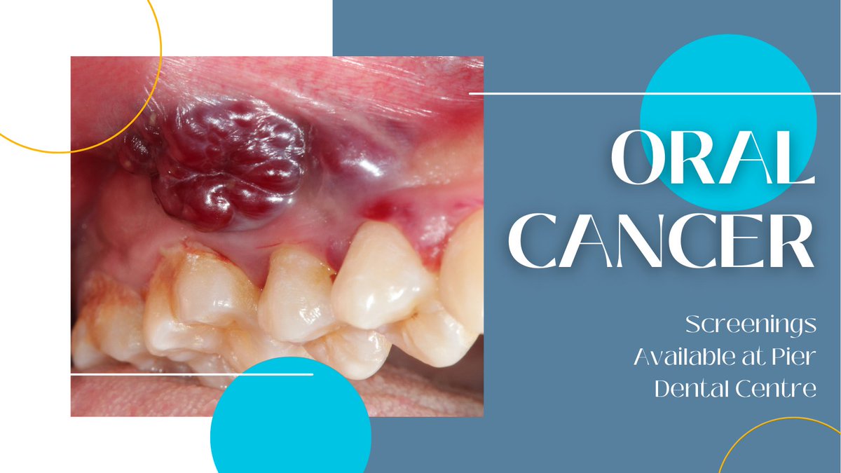 When it comes to oral cancer - the earlier it's caught, the easier it is to treat. 👍 We offer oral cancer screenings which include a thorough visual exam of your neck, throat, mouth, and cheeks. Book your next checkup and screening today!