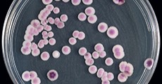 APIC's tweet photo. Need guidance on Candida auris prevention? Check out APIC's playbook, designed to help IPs quickly implement effective strategies in healthcare settings. Learn more: https://t.co/ulkkNvR9Ur

#InfectionPrevention #CandidaAuris #Cauris #IPC #HAIs https://t.co/b3JaYc31T2