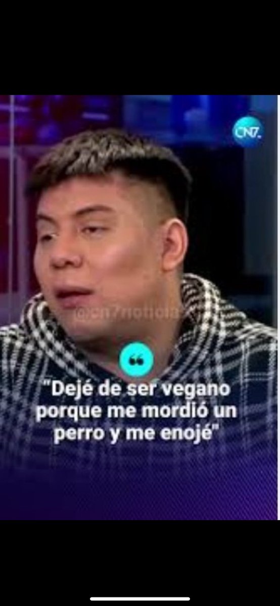 Me acaban de morder mis perros en unas de sus peleitas.
Estoy asi: