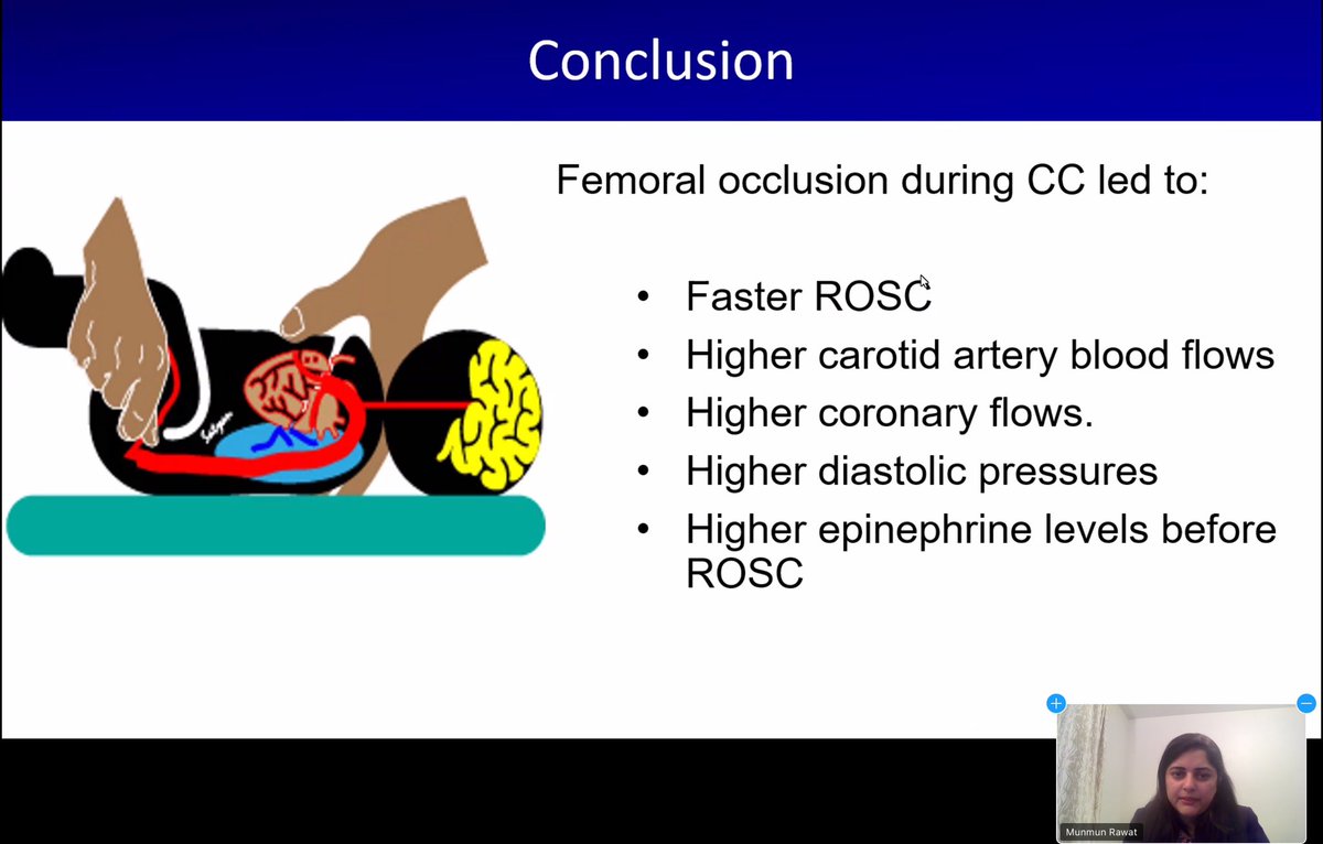 Dr. @munmun_rawat presenting her NIH-funded work on improving coronary perfusion during #NeoResus at @CANcoolNEO Research meeting