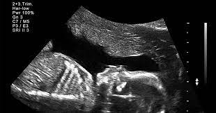 ChipCors tweet media