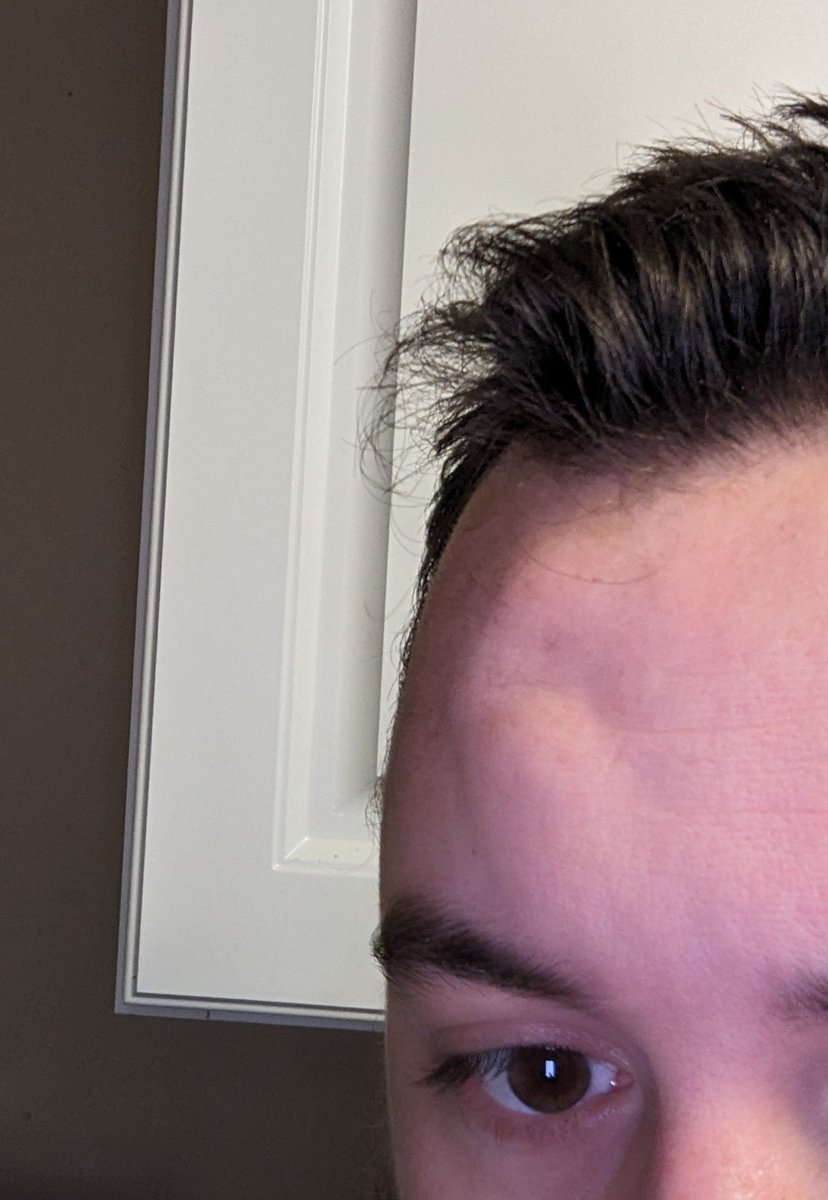 @oldenoughtosay I have a permanent 'goose-egg' bump on my forehead from falling down the stairs at 2 years old. It just never went away. It's not hard or tender.