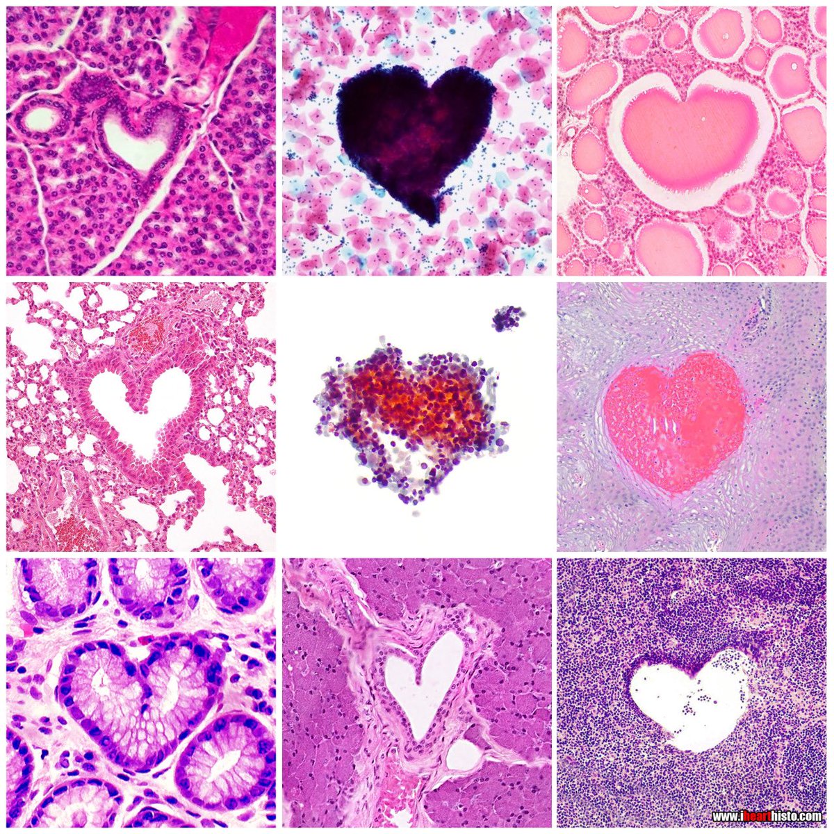 You can find love in the strangest of places (OG Version)

Clockwise, top left to center

In a:
1 pancreas
2 Pap smear
3 thyroid follicle
4 anal canal
5 lymph node
6 parotid gland
7 colonic crypt
8 bronchiole
9 lung carcinoma

#histology #anatomy #pathology #ValentinesDay