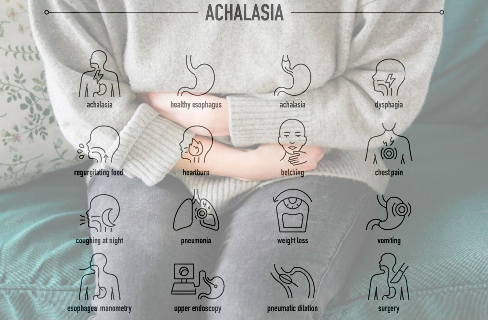 IMJ February 2024 #OpenAccess Original Article: Clinical management of achalasia bit.ly/48St0RC @marrow @TheRACP @WileyHealth @Russeldm