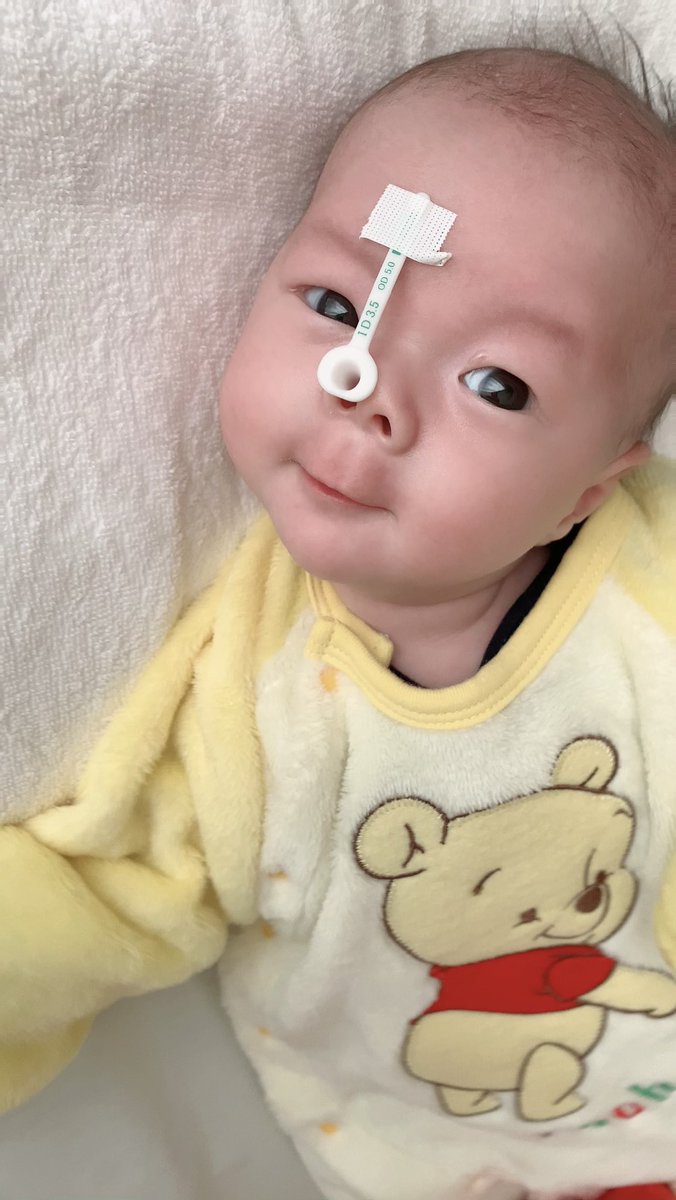____kittymms's tweet photo. エアウェイ付けた状態だけど元気に成長してます😊
 #男の子ママ
 #男の子ベビー https://t.co/gDITqOWO4C