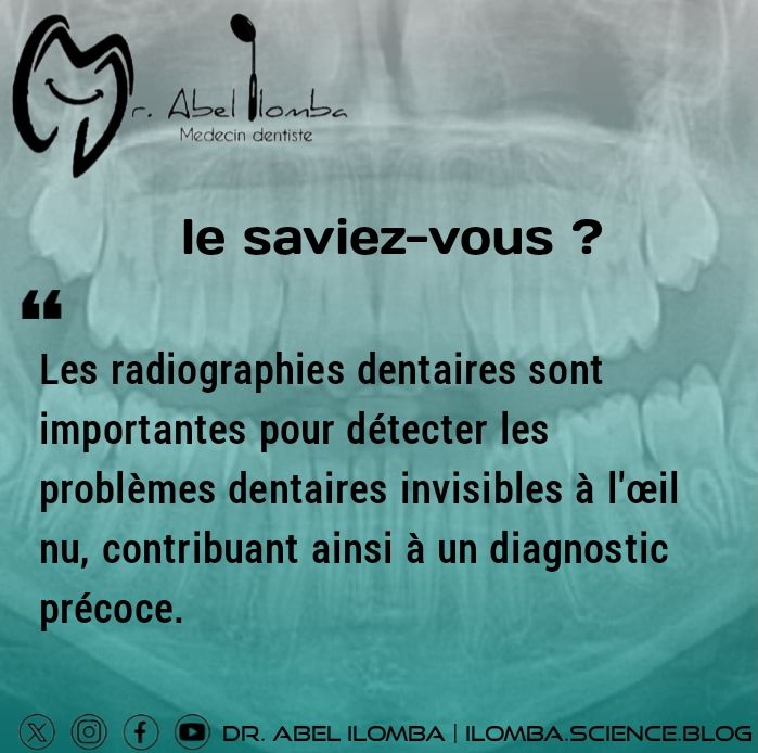 LE SAVIEZ-VOUS ? 

Les radiographies dentaires sont importantes pour détecter les problèmes dentaires invisibles à l'œil nu, contribuant ainsi à un diagnostic précoce.

Dr. @Abel_Ilomba
