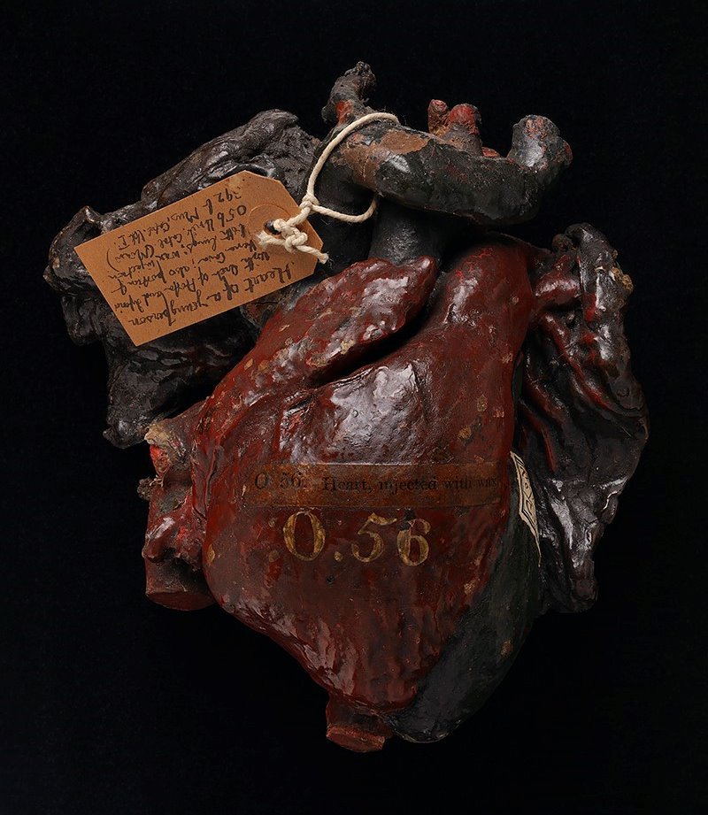 #valentinesday2024. This rare, wax-injected #heart is one of the earliest in our collection. Likely to be from an 18c dissection & one of several hundred specimens we can directly link to the work of the #Monro dynasty of #Anatomy Professors @EdinUniMedicine #histmed #Edinburgh