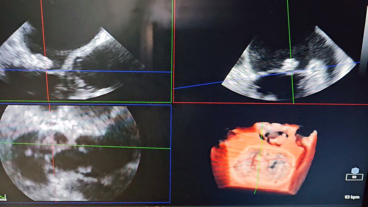 Enrico Bonnì tweet media