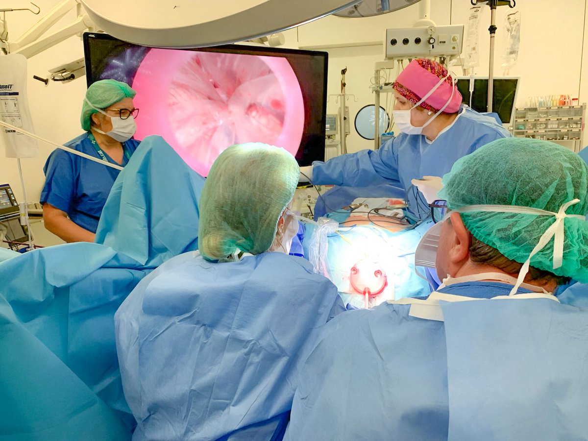 Hospitaligd's tweet photo. L’Hospital Universitari d’Igualada ha realitzat amb èxit la primera laparoscòpia per via vaginal 🔝, una tècnica quirúrgica que s’incorpora a la cartera de serveis de l’àrea de ginecologia del nostre centre 🏥.

Més informació 👉 https://t.co/qsrwm7QTbF https://t.co/ECP0Qqh1mf