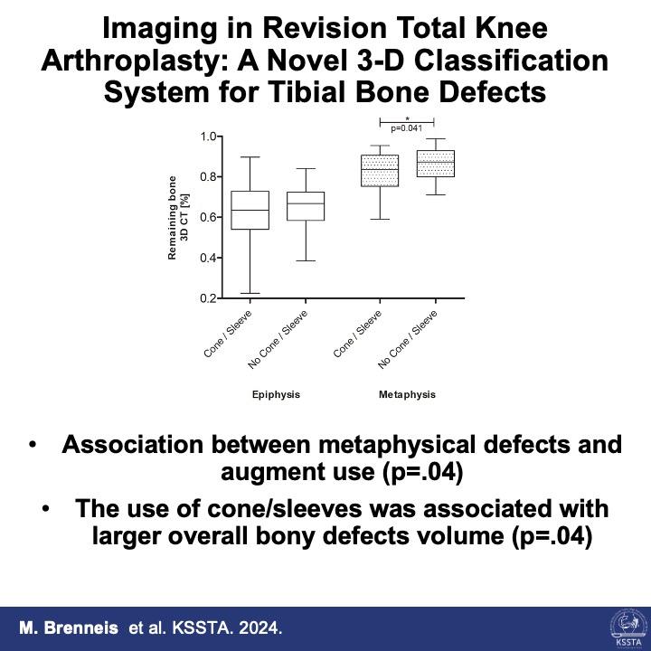 KSSTA's tweet photo. A new classification of bone defects on a 3D-CT scan can help you evaluate the tibial defect and plan for augment/cones before surgery!
#knee #revision #totalknee #bonedefects #orthopaedics #arthroplasty #TKA
Find out more here: https://t.co/4dd1PkEHhC https://t.co/9pMXaMZNAl
