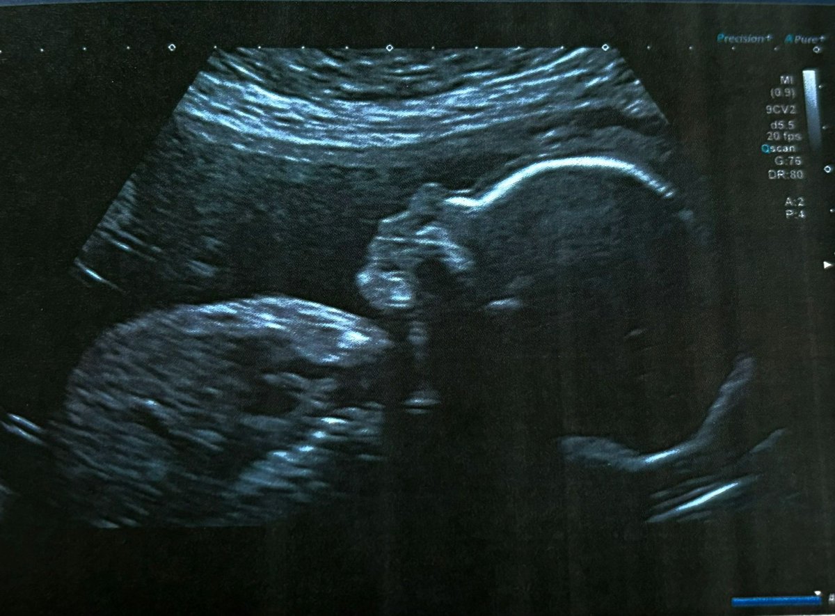 Mister Crimson tweet media