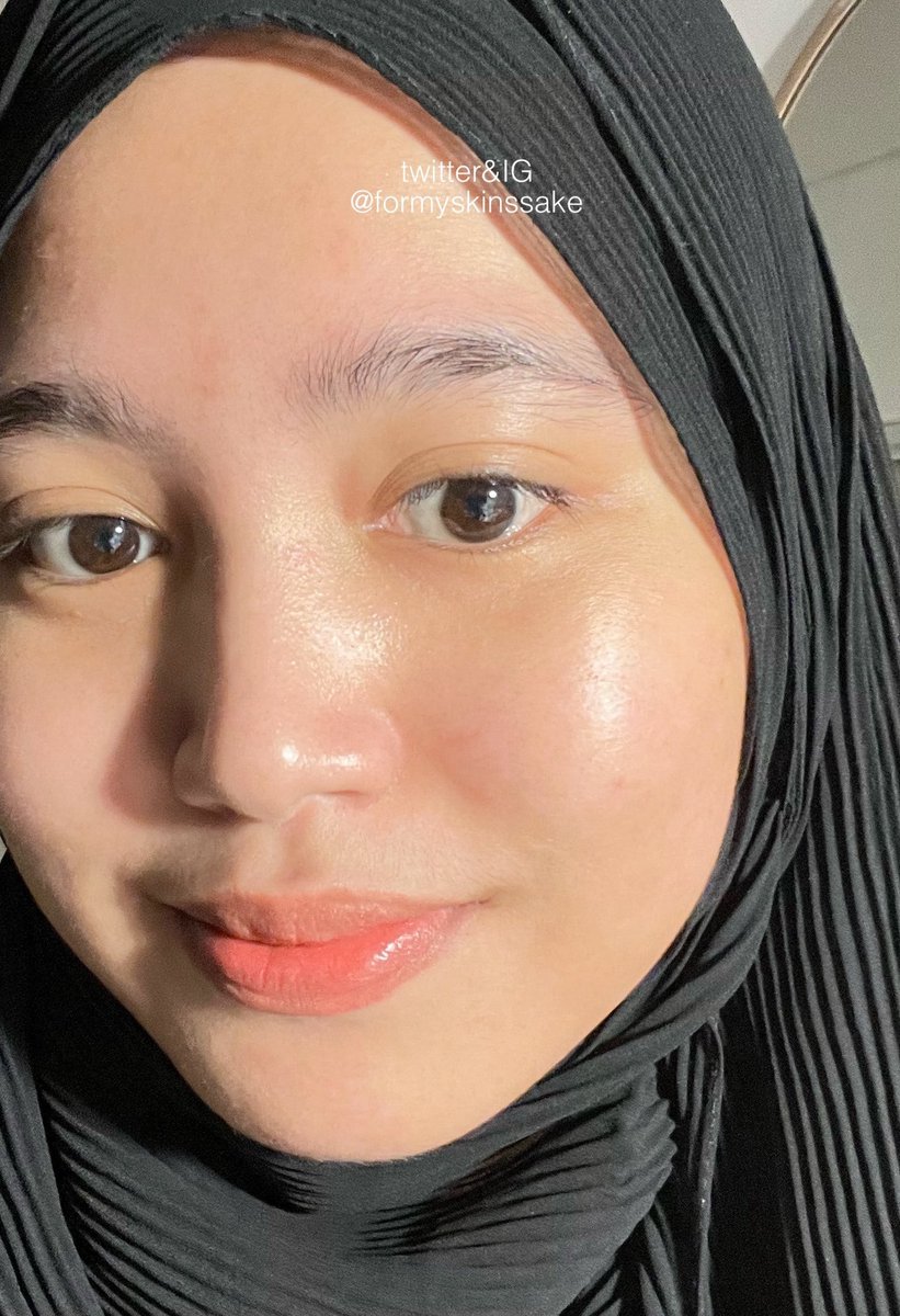 ✨You Are What You Eat✨

Ini rekor banget si udah dari Desember, berarti kurang lebih 3 bulan yaa 

Alhamdulilllah gak ada jerawat gede, bekas jerawat gampang pudar, padahal gak ada facial samsek, skincare juga gt gt aja 🥹🥹 SENENG BANGET! 

#RacuninSkincare #Refiew