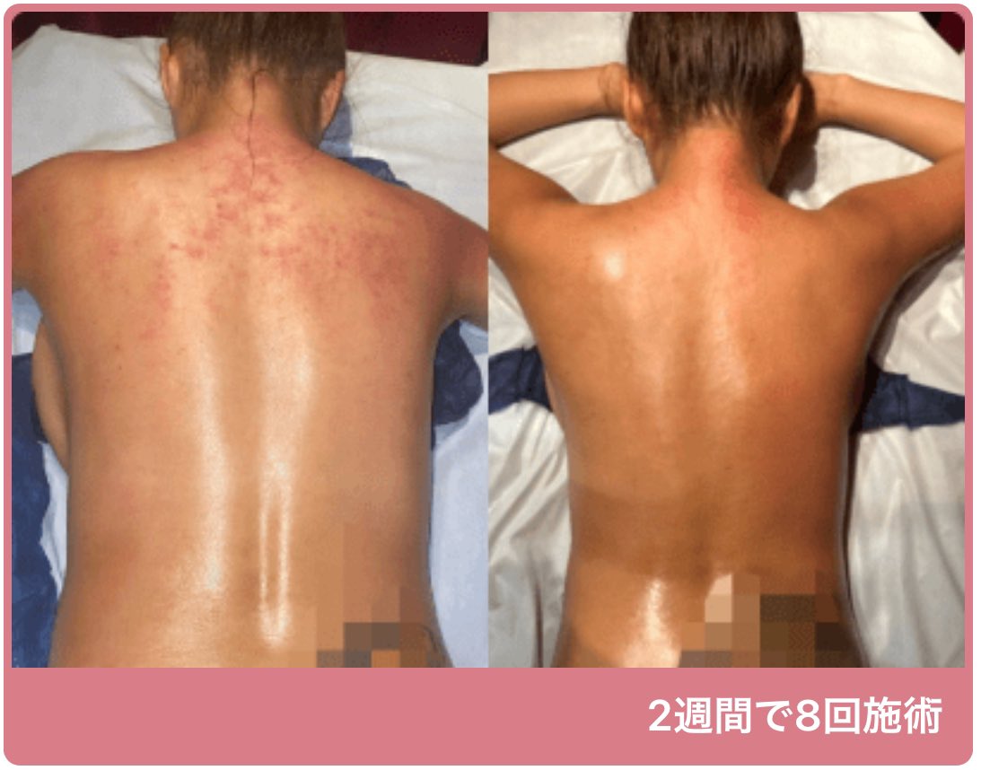 これ見てやらない理由がない
#セルクラ®︎
#セルライトクラッシュ
#Speed美人