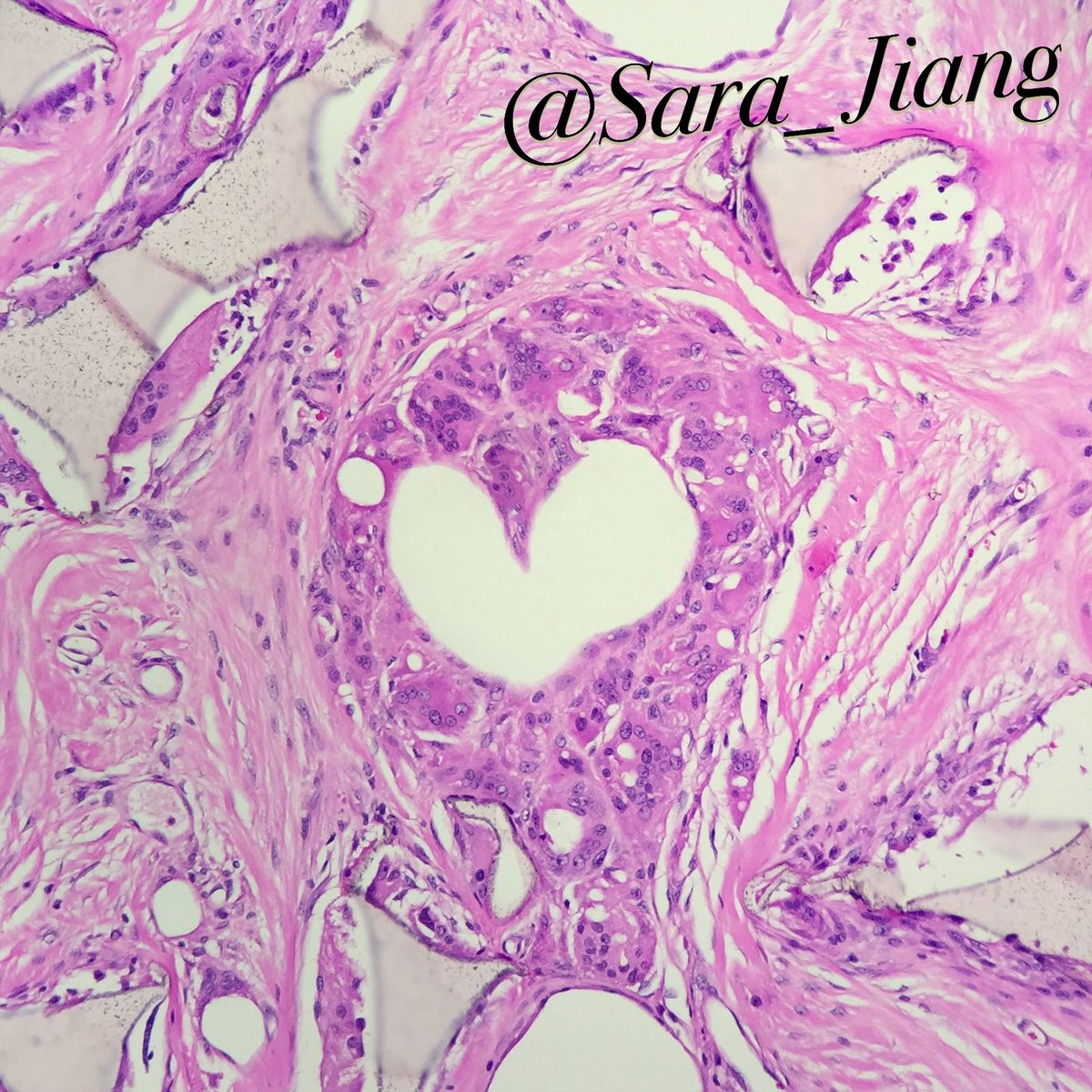 Xiaoyin "Sara" Jiang, MD (She/Her) tweet media