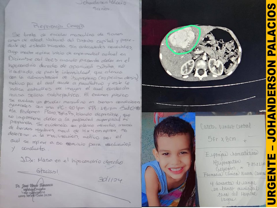 Hola a todos:
Él es Johanderson, de 5 años, diagnosticado con Tumor en Hígado y Colon con metástasis hospitalizado en JM de los Ríos Caracas
Sus familiares no cuentan con los recursos necesarios para atender todos los requerimientos. 
Yorgelis (madre): 0412-9758531 / 0412-4843291
