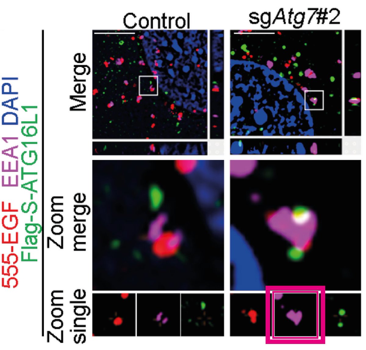 Jane_Dudley_Lab's tweet image. #ValentinesDay... science-style! 👩‍🔬🫶
 
About 5 yrs ago I was looking at some super-res microscopy &amp;amp; was so excited to find an early endosome (marked by EEA1) in the shape of a heart!💕 Obvs the feeling is mutual

@gammoh_lab @EdinUni_IGC embopress.org/doi/full/10.15…