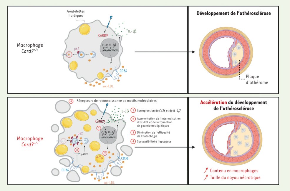 L’invalidation du gène Card9 chez la souris favorise l’#athérosclérose par un défaut d’#autophagie dans les #macrophages de la paroi vasculaire. À lire. bit.ly/3SVEwpX #openaccess @univ_paris_cite @Inserm @parcc_inserm