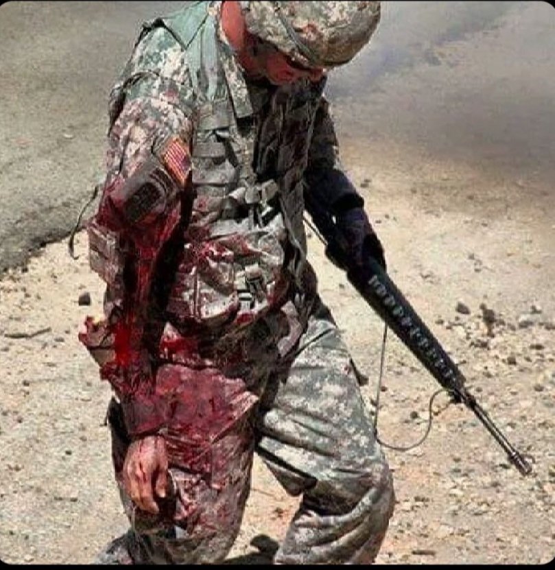 while some asshole is kneeling during the anthem there is a hero taking a bullet to give that asshole the freedom to disrespect his sacrifice. STAND THE HELL UP !!!!!!