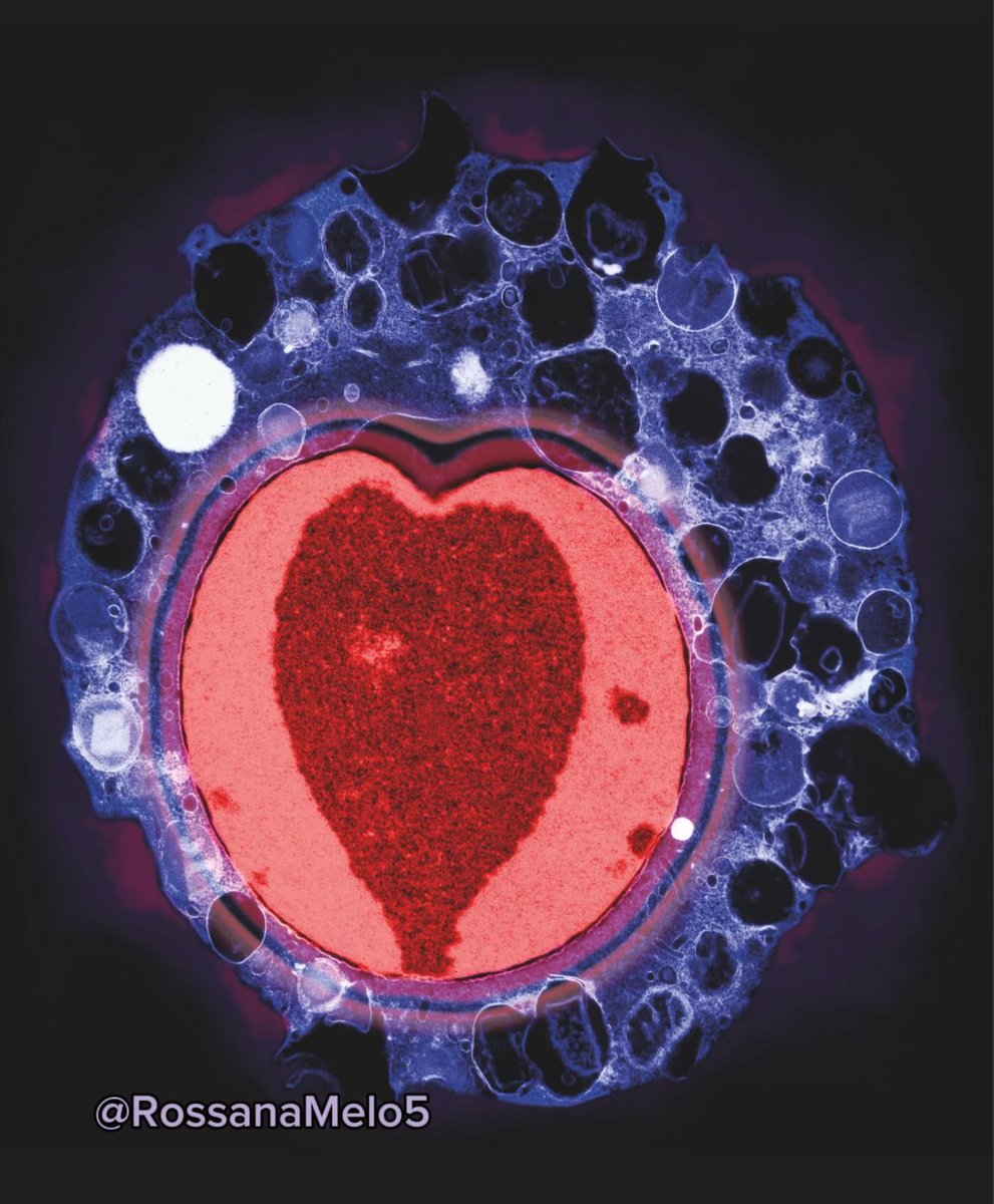 Dying for love! ❤️ Happy #ValentinesDay with this apoptotic #eosinophil in love seen under #electronmicroscopy #sciart