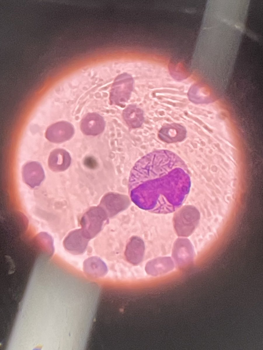 Just a classic! 🦯🦯🦯 <a href="/cito_tuiter/">CitoTweet</a> <a href="/GHematologica/">Grupo Español de Citología Hematológica</a>