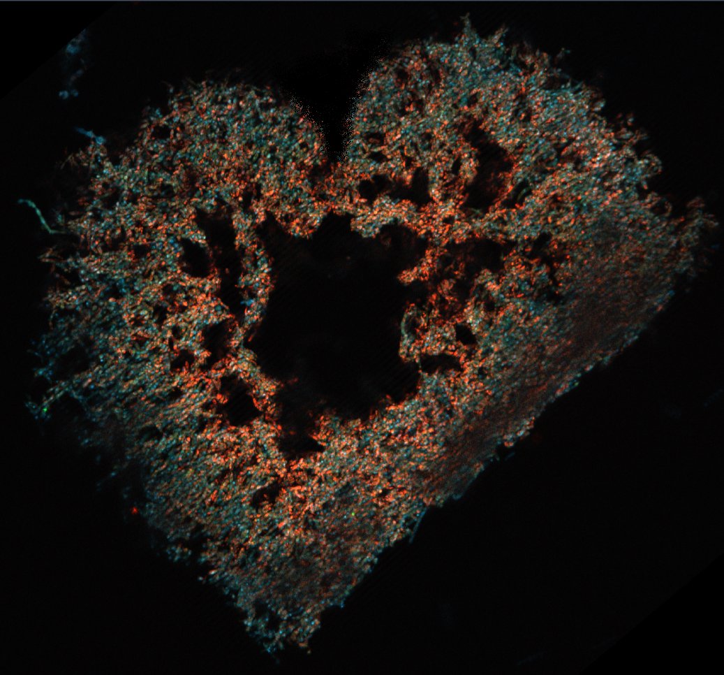 Today I'm sharing this retinal organoid picture to remind you to always #loveyoureyes 👁️ 
#academicValentines #visionresearch #stemcells #organoids #Eyehealth #lowvisionmonth #AMDawarenessmonth #sciart