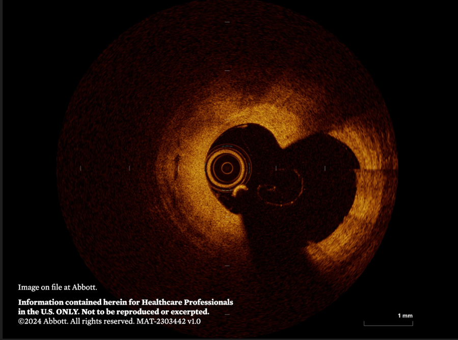 Abbott Cardiovascular tweet media