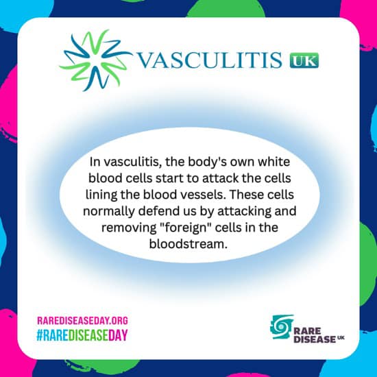 ZoiAn2's tweet image. 15 days to the #RareDiseaseDay, #vasculitis is a rare  #rheumatic #autoimmune disease! #raredisease There are over 18 different types of vasculitis, each type extremely rare in its own right!
We are supporting #rarediseaseday24