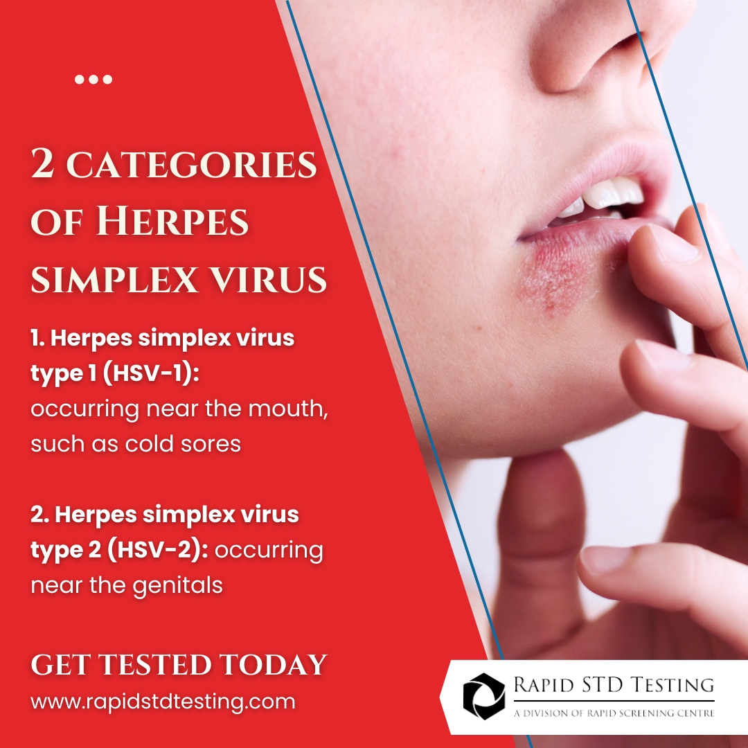 The Herpes simplex virus has two types: HSV-1, causing cold sores near the mouth, and HSV-2, associated with genital herpes.

Understanding these distinctions is essential for effective management.

🌐 rapidstdtesting.com
📞 866-872-1888

#HerpesAwareness #rapidstdtesting